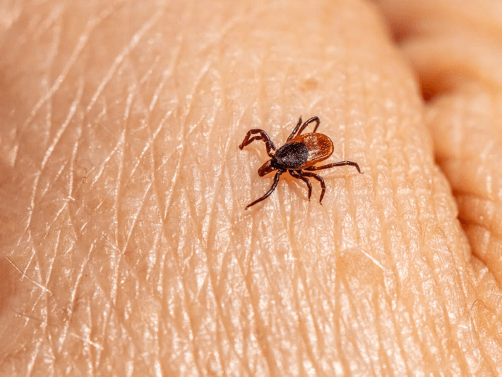 pest control inglewood